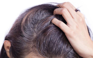 6 cách trị tóc bạc sớm tại nhà hiệu quả với các mẹo dân gian