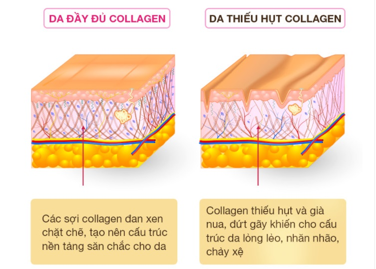 Collagen tươi - chân ái của mọi làn da